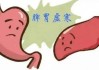 脾胃虚寒带来的危害有哪些 脾胃虚寒该如何调理
