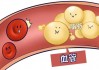 降血脂的五种水果是什么 血脂过高有什么危害