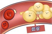 降血脂的五种水果是什么 血脂过高有什么危害