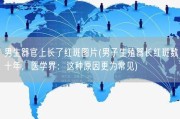 男生器官上长了红斑图片(男子生殖器长红斑数十年，医学界：这种原因更为常见)