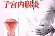 子宫内膜炎的症状是什么 子宫内膜炎可以热敷吗