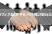 鸡眼怎么治能彻底根除(彻底根除鸡眼的治疗方法)