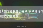 男人割了皮包什么样子(男子进行包皮切除后的新形象)