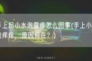 手上起小水泡很痒怎么回事(手上小水泡痒痒，原因何在？)
