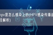 hpv是怎么感染上的(HPV感染传播途径解析)