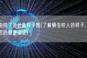 螨虫咬了是什么样子图(了解螨虫咬人的样子，保障您的健康安全)
